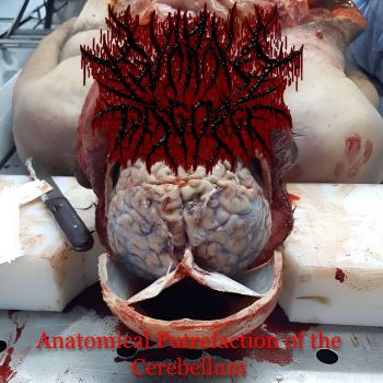 Entrail Disgorge - Anatomical Putrefaction of the Cerebellum (2025)