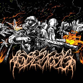 Asbestosis - Asbestosis (2025)