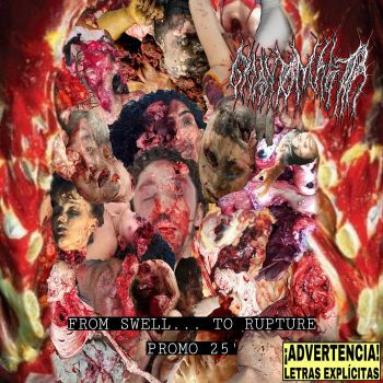 Gigantomastia - From Swell... to Rupture (2025)