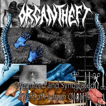 Organ Theft - Organized and Syndicated Theft of Human Organ (2021)