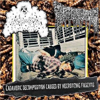 Обложка: Carne Molida / Nervous Body - Cadaveric Decomposition Caused by Necrotizing Fasciitis (2025)