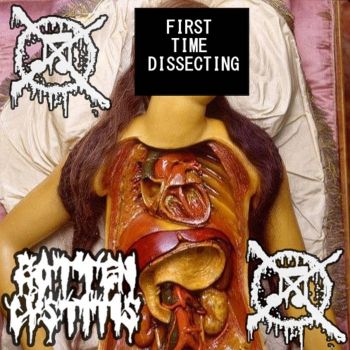 Обложка: Rotten Cystitis - First Time Dissecting (2025)
