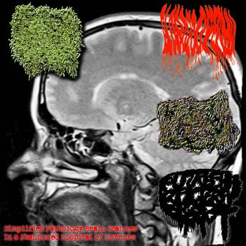 Обложка: Mangoworm Infestation in a Worthless Human Cadaver / Globozoospermia / Clogged Gastrostomy Tumour Fluid / Putrefying Bacteria in the Digestive Tract - Simplified Pathology Brain Scanner in a Abandoned Hospital of Horrors (2025)
