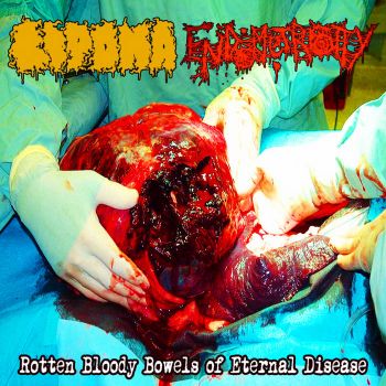 Обложка: Lipoma / Endometriosity - Rotten Bloody Bowels of Eternal Disease (2025)