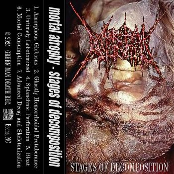 Mortal Atrophy - Stages of Decomposition (2025)