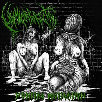 Hemicorporectomy - Genital Mutilation (2025)