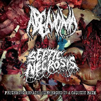Обложка: Adenoma / Septic Necrosis - Festering Remains Submerged in a Caustic Bath (2025)