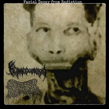Обложка: Craniofacial Degloving / Komodonesia - Facial Decay from Radiation (2025)