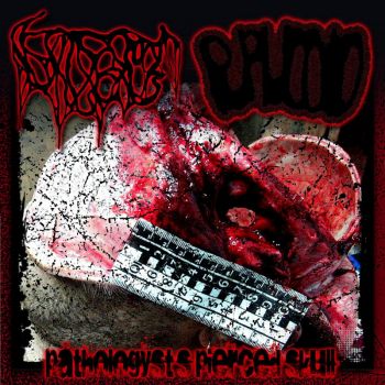 Обложка: Vaginally Consuming Broken Glass / Puruloid - Pathologists Pierced Skull (2025)