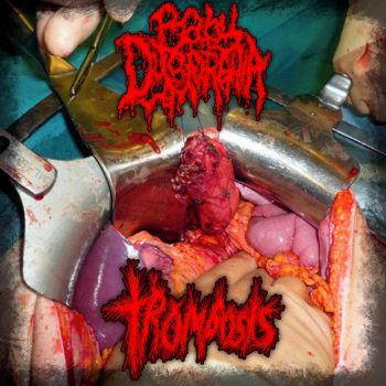 Обложка: Baby Dysmorphia / Trombosis - Split (2025)