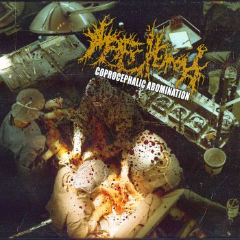 Обложка: Faexemia - Coprocephalic Abomination / Shitborne Rot (2025)