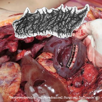 Fetal Fluids - Gastroenterological Paradoxical Surgical Influence (2024)