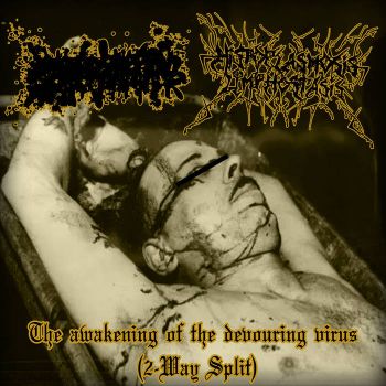 Histoplasmosislymphostasis / Brutal Russian Strapon Attack - The Awakening of the Devouring Virus (2025)