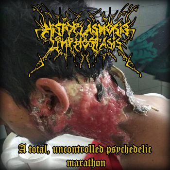 Histoplasmosislymphostasis - A Total, Uncontrolled Psychedelic Marathon (2025)