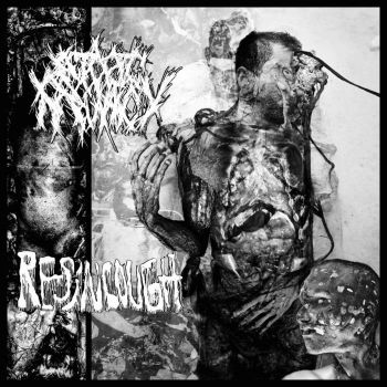 Обложка: Ectopic Pregnancy / Resin Cough - Split (2025)