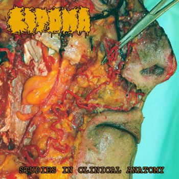 Lipoma - Studies in Clinical Anatomy (2025) Обложка: Lipoma - Studies in Clinical Anatomy (2025)