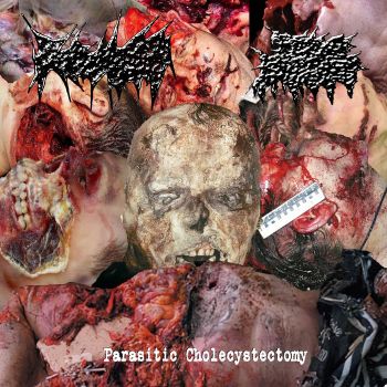 K9 Hemorrhoids / Bile Ducts - Parasitic Cholecystectomy (2025) Обложка: K9 Hemorrhoids / Bile Ducts - Parasitic Cholecystectomy (2025)