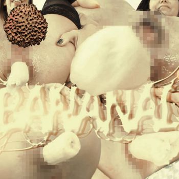 Torsion Testiculaire - Bananal (2025)