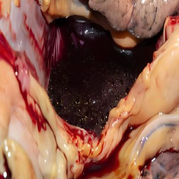 Обложка: Malignant - Malignant (2025)