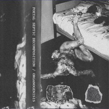 Organogenisis / Foetal Septic Decomposition - Split (2025) Обложка: Organogenisis / Foetal Septic Decomposition - Split (2025)