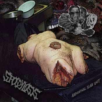 Spondylosys - Abdominal Slab Unit (2025) Обложка: Spondylosys - Abdominal Slab Unit (2025)