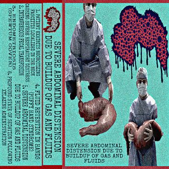 Xylazine Prophylactic - Severe Abdominal Distension Due to Buildup of Gas and Fluids (2025) Обложка: Xylazine Prophylactic - Severe Abdominal Distension Due to Buildup of Gas and Fluids (2025)