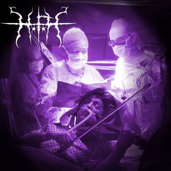 Hematofoliculohidrosis - EP-I (2025)
