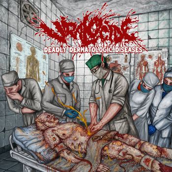 Viralocide - Deadly Dermatologic Diseases (2026)