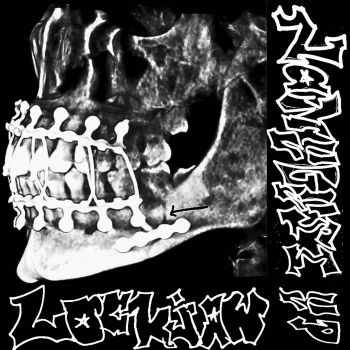 Lockjaw - Nameless (2026)
