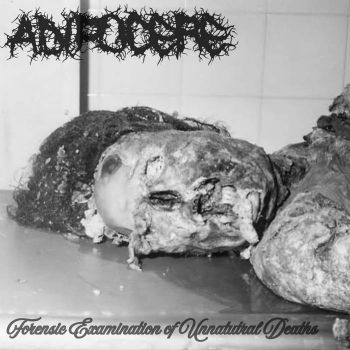Adipocere - Forensic Examination of Unnatural Deaths (2026)