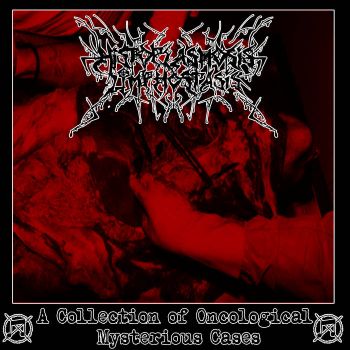 Histoplasmosislymphostasis - A Collection of Oncological Mysterious Cases (2026)