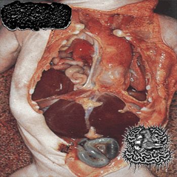 Birth Defects / TxTxS - Split (2026)