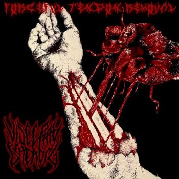 Visceral Beheading - Forceful Tendon Removal (2026)