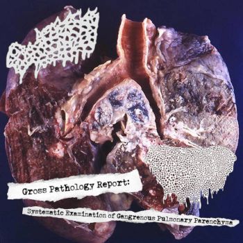 Saccharomyces Cerevisiae / Liberation - Gross Pathology Report: Systematic Examination of Gangrenous Pulmonary Parenchyma (2026)