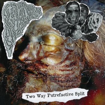 Hemorrhagic Necrotizing Enterocolitis / Gangrenous Necrosis - Two Ways Putrefactive Split (2025)