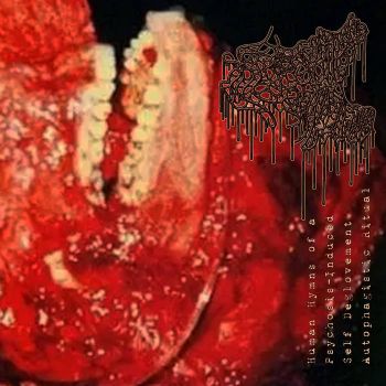 Psychosomatic Cryoglobulinemia - Human Hymns of a Psychosis-Induced Self Deglovement Autophagistic Ritual (2026)
