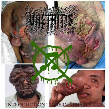 Uretritis - Introduction to Dermapathology (2026)