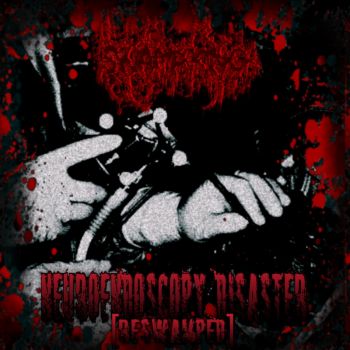 Swamp King - Neuroendoscopy Disaster (Reswamped) (2026)