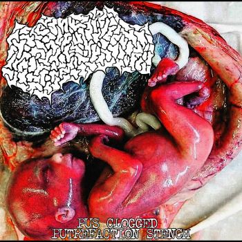 Prenatal Hepatoblastoma - Pus Clogged Putrefaction Stench (2026)