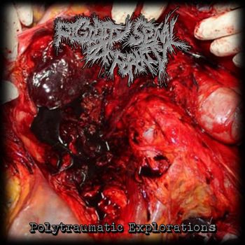 Rigidity Spinal Deformity - Polytraumatic Explorations (2026)