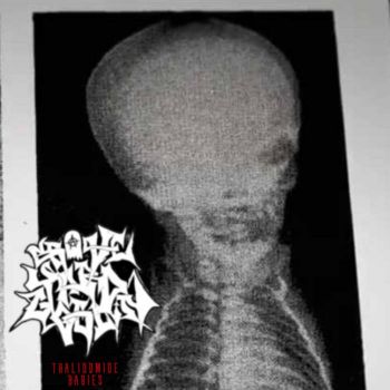 Graveyard Goblin - Thalidomide Babies (2026)