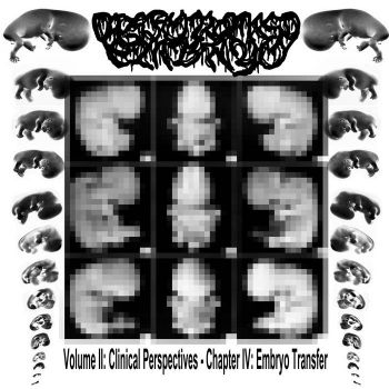 Disformed Embryo - Volume II: Clinical Perspectives - Chapter IV: Embryo Transfer (2026)