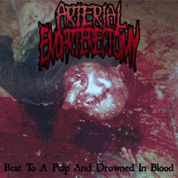 Arterial Endarterectomy - Beat to a Pulp and Drowned in Blood (2026)