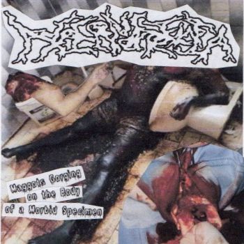 Hypernatraemia - Maggots Gorging on the Body of a Morbid Specimen (2026)
