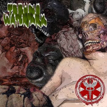 Techno Waterpark / Medical Teratocarcinoma Anus - Advance in Medicine (2026)