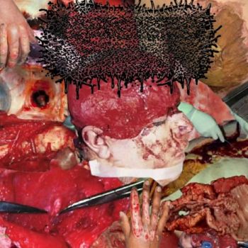 Fumes of Exhumation - Gluttonous Mass of Human Remnants Secreting Copious Amounts of Pus (2026)