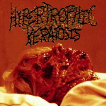 Hypertrophic Keratosis - Hypertrophic Keratosis (2025)