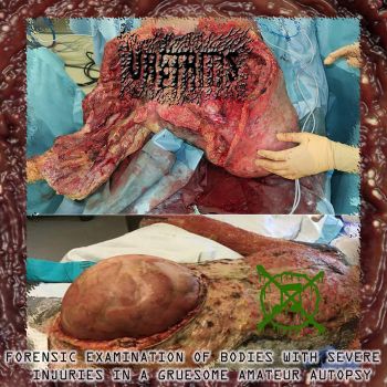 Uretritis - Forensic Examination of Bodies with Severe Injuries in a Gruesome Amateur Autopsy (2026)