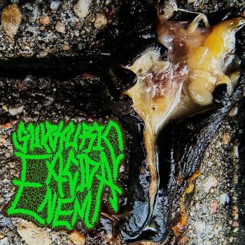Sulphuric Acid Enema - Sulphuric Acid Enema (2025)