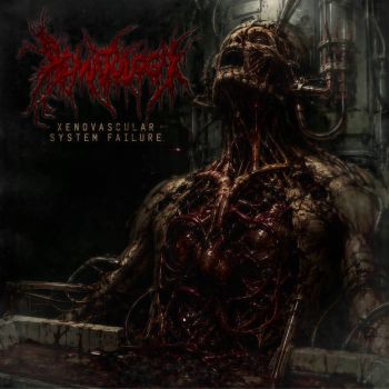 Hematology - Xenovascular System Failure (2026)